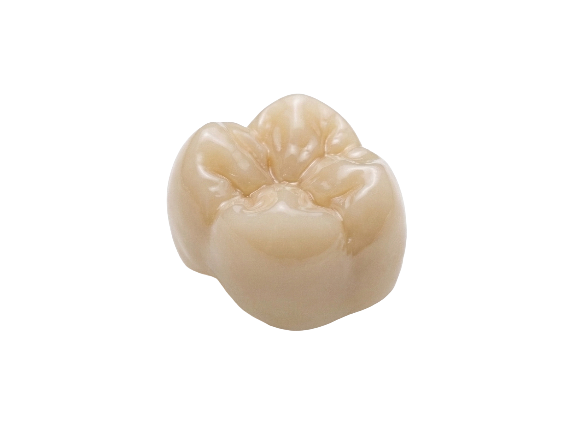 Precision-milled zirconia dental crown